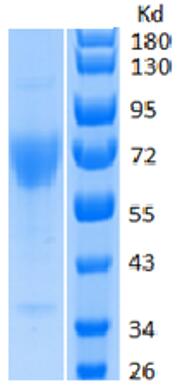 SDS-PAGE analysis of purified human GUCY2C 3 ug/Line, Reduced.